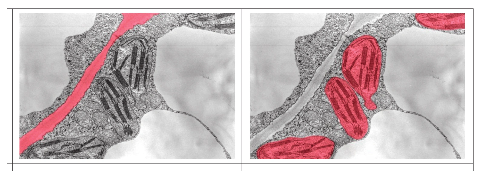 Biologia R, matura 2026 CKE termin dodatkowy — Zadanie 2.1 (struktury zaznaczone na zdjęciu TEM, czerwony overlay) · Arkusz CKE czerwiec 2026; jak `bio-r-2026cz-z2.webp` · CKE · dozwolony użytek (art. 27 pr. aut.)