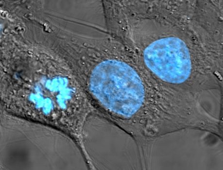 Komórki nowotworowe HeLa (jądra wybarwione); po lewej komórka w trakcie podziału ze skondensowanymi chromosomami · źródło: TenOfAllTrades, Wikimedia Commons, domena publiczna