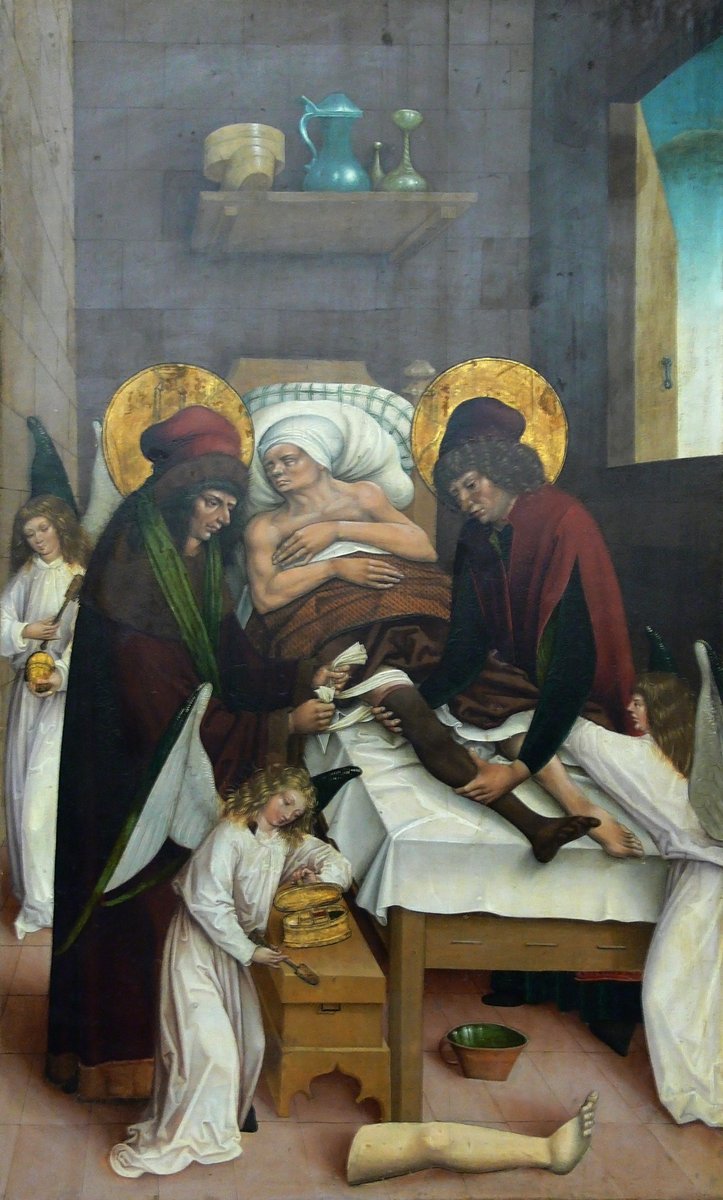 Cud świętych Kosmy i Damiana — legendarny przeszczep nogi (ok. 1550), najwcześniejsze wyobrażenie transplantacji w sztuce · źródło: Mistrz ołtarzy ze Stetten i Schnait, Wikimedia Commons, domena publiczna