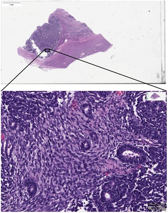 Fragment cyfrowego preparatu histopatologicznego. Takie obrazy mają miliardy pikseli, więc sieć analizuje je fragmentami w pełnym powiększeniu — tu zmniejszenie rozdzielczości byłoby błędem (Jednostka 12.1)